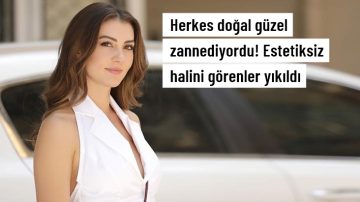 Herkes doğal güzel zannediyordu! Burcu Özberk’in estetiksiz halini görenler yıkıldı