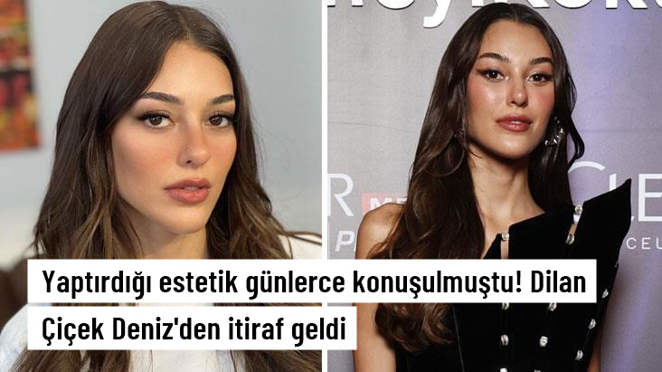 Estetik kurbanı olan Dilan Çiçek Deniz’den itiraf: